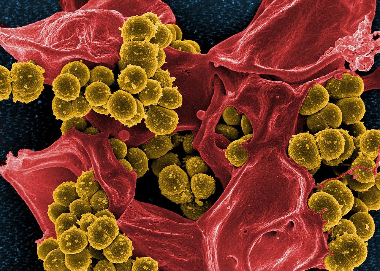 Colorized electron microscope image of MRSA bacteria clustered around a dead human white blood cell