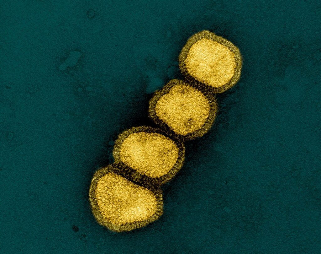 Flu Season Arrives Months Early as Experts Watch a Mutated H1N1 Strain