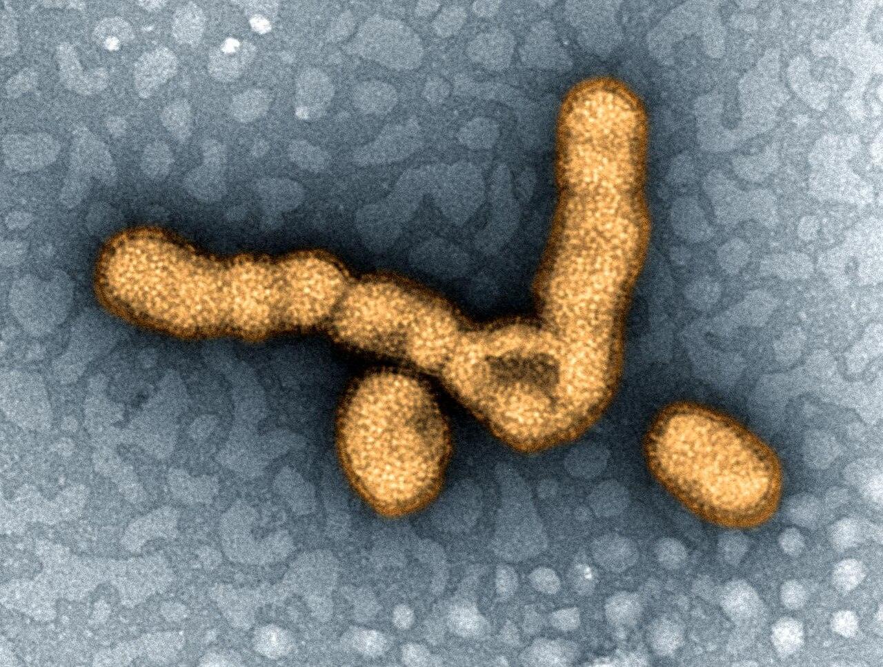 Microscope image of H1N1 influenza virus particles from NIAID